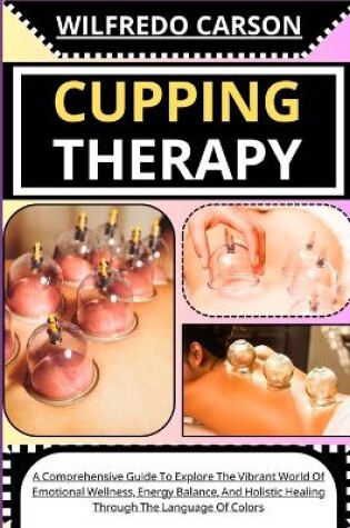 Cover of Cupping Therapy