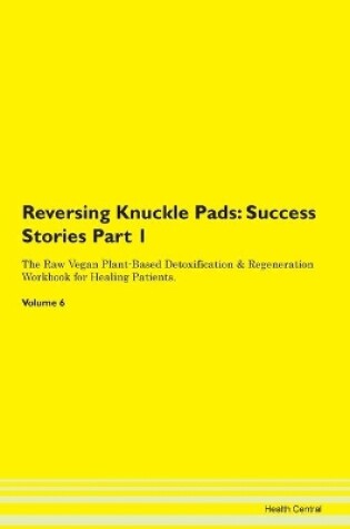 Cover of Reversing Knuckle Pads