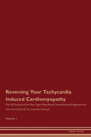 Cover of Reversing Your Tachycardia Induced Cardiomyopathy