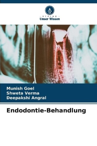 Cover of Endodontie-Behandlung