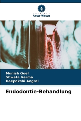 Book cover for Endodontie-Behandlung