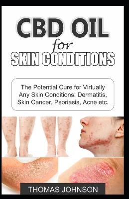 Book cover for CBD Oil for Skin Conditions