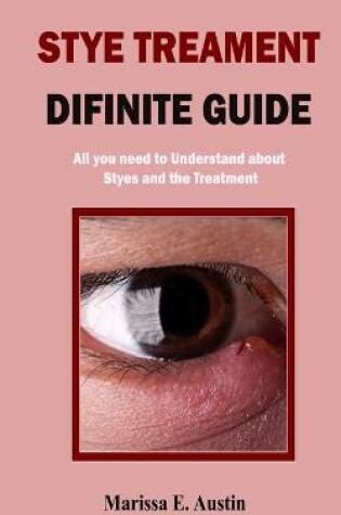 Cover of Stye Treatment Difinite Guide