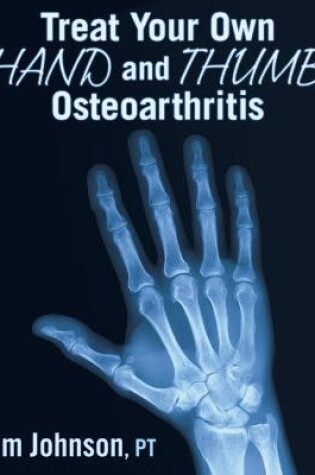 Cover of Treat Your Own Hand and Thumb Osteoarthritis