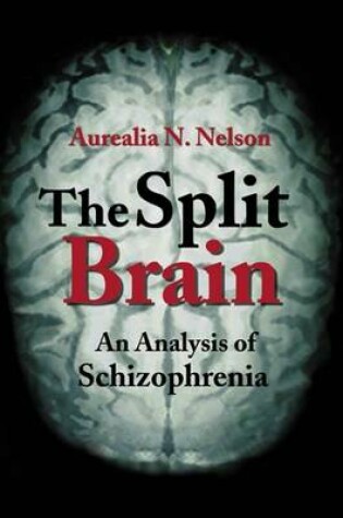 Cover of The Split Brain