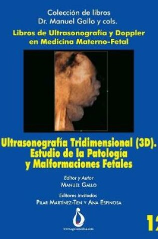 Cover of Ultrasonograf a Tridimensional (3d). Estudio de la Patolog a Y Malformaciones Fetales