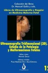 Book cover for Ultrasonograf a Tridimensional (3d). Estudio de la Patolog a Y Malformaciones Fetales