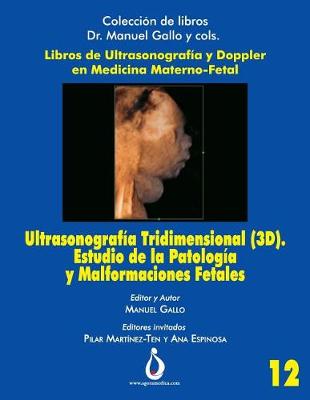 Book cover for Ultrasonograf a Tridimensional (3d). Estudio de la Patolog a Y Malformaciones Fetales