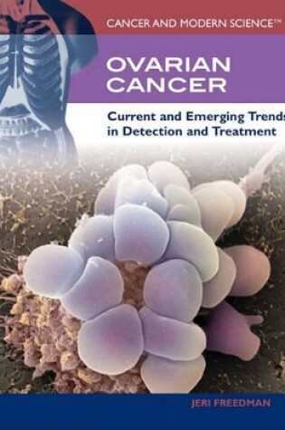 Cover of Ovarian Cancer