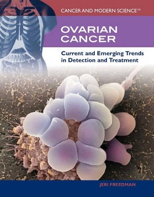 Book cover for Ovarian Cancer