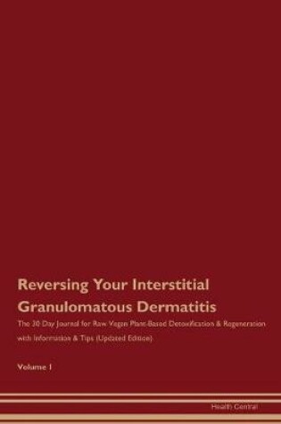 Cover of Reversing Your Interstitial Granulomatous Dermatitis