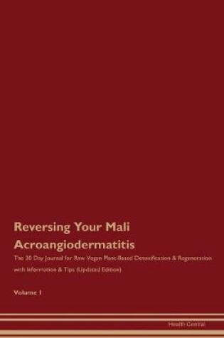 Cover of Reversing Your Mali Acroangiodermatitis