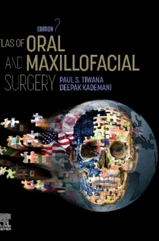 Cover of Atlas of Oral and Maxillofacial Surgery - E-Book