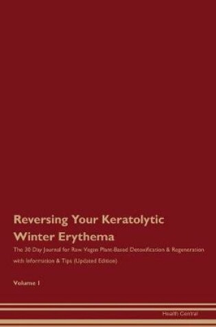 Cover of Reversing Your Keratolytic Winter Erythema