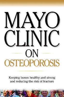 Book cover for Osteoporosis