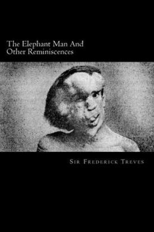 Cover of The Elephant Man and Other Reminiscences