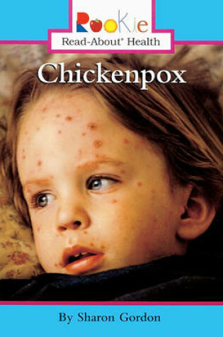Cover of Chickenpox