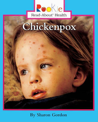 Cover of Chickenpox