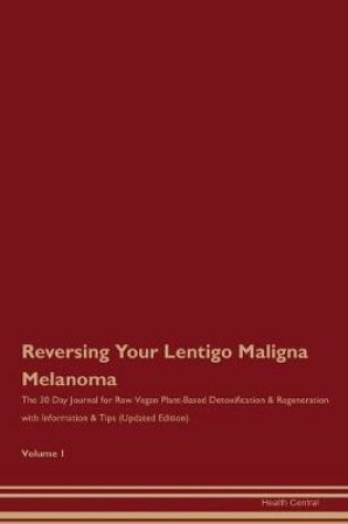 Cover of Reversing Your Lentigo Maligna Melanoma