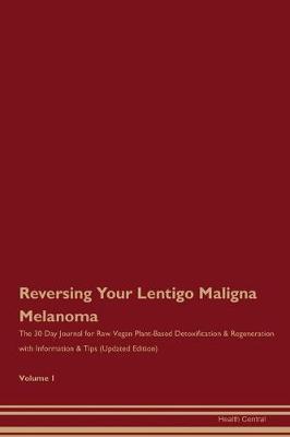 Book cover for Reversing Your Lentigo Maligna Melanoma