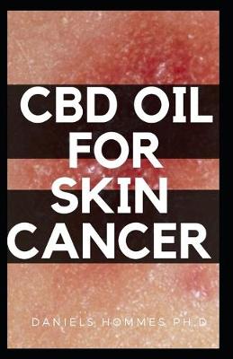 Book cover for CBD Oil for Skin Cancer