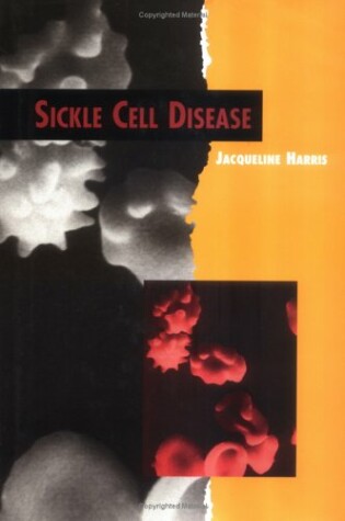 Cover of Sickle Cell Disease