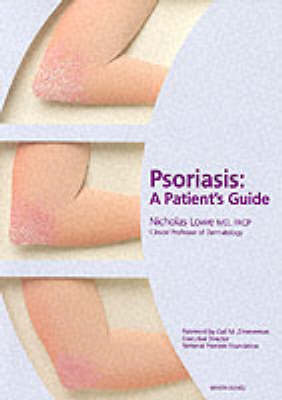 Book cover for Psoriasis