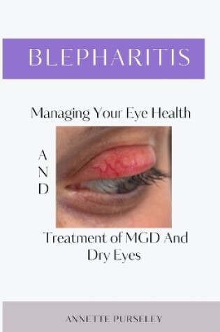 Cover of Blepharitis