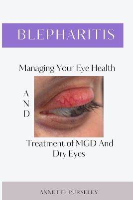 Book cover for Blepharitis