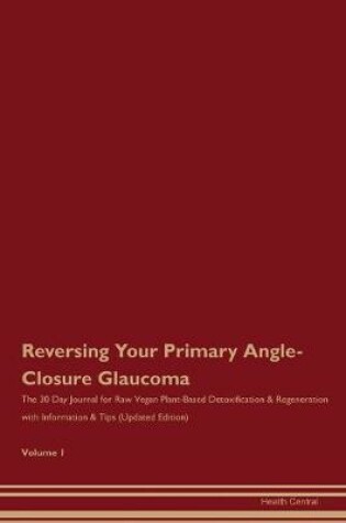 Cover of Reversing Your Primary Angle-Closure Glaucoma