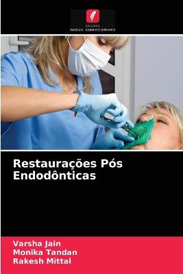 Book cover for Restaurações Pós Endodônticas