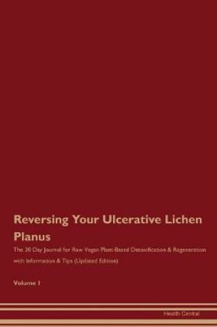 Cover of Reversing Your Ulcerative Lichen Planus