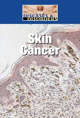 Book cover for Skin Cancer