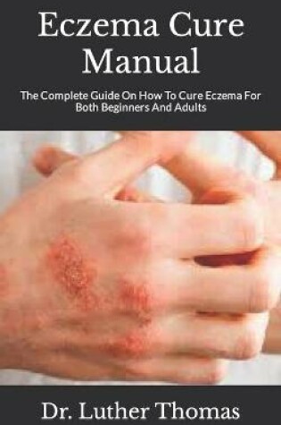 Cover of Eczema Cure Manual