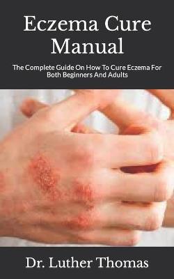 Book cover for Eczema Cure Manual