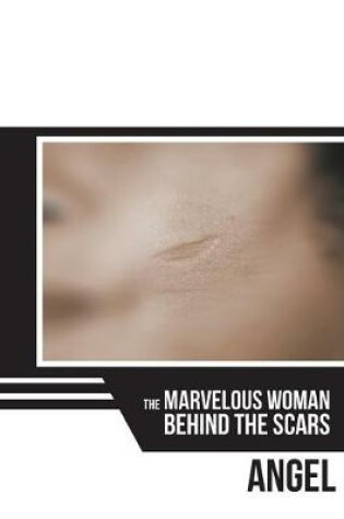 Cover of The Marvelous Woman Behind the Scars