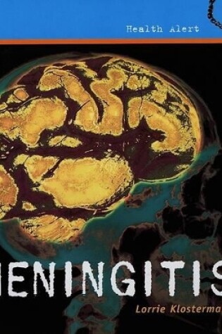 Cover of Meningitis