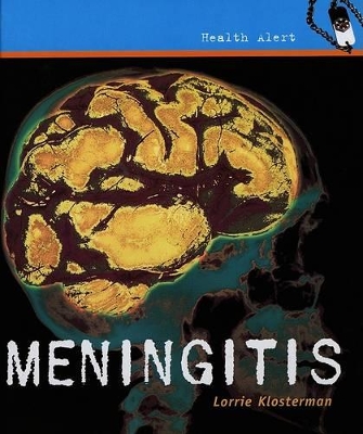Book cover for Meningitis