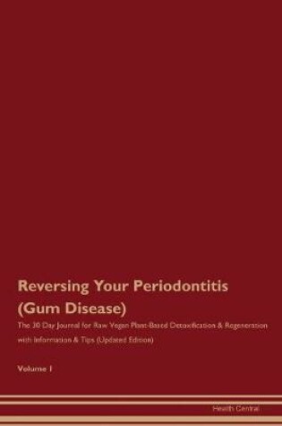 Cover of Reversing Your Periodontitis (Gum Disease)