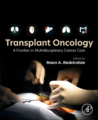 Cover of Transplant Oncology