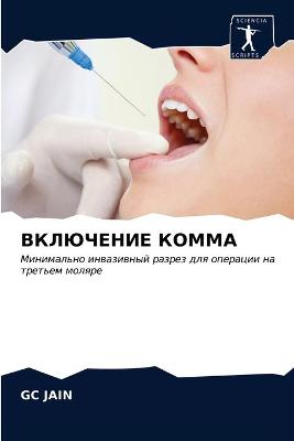 Book cover for ВКЛЮЧЕНИЕ КОММА