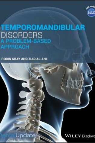 Cover of Temporomandibular Disorders