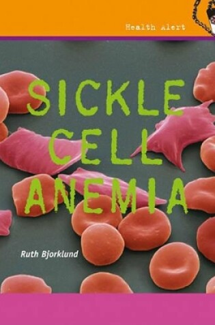 Cover of Sickle Cell Anemia