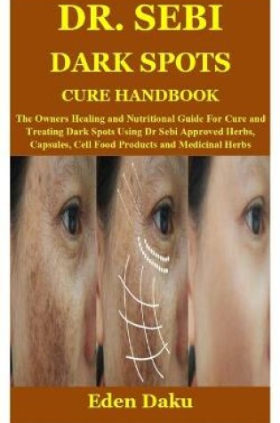 Cover of Dr. Sebi Dark Spots Cure Handbook