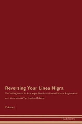 Cover of Reversing Your Linea Nigra