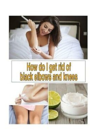 Cover of How do I get rid of black elbows and knees