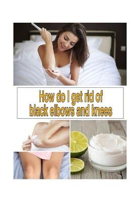 Book cover for How do I get rid of black elbows and knees