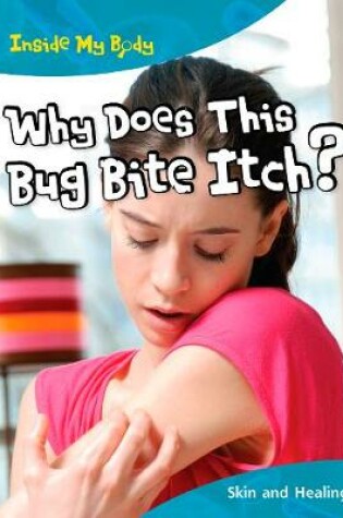 Cover of Why does this Bite Itch?