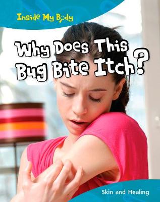 Book cover for Why does this Bite Itch?