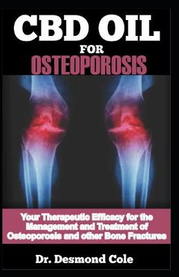 Book cover for CBD Oil for Osteoporosis